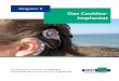 Ratgeber 8 Das Cochlea- Implantat - schwerhoerigen-netz.de · Der Deutsche Schwerhörigen- bund wird gefördert durch die KKH. Für die Inhalte dieser Veröffentlichung übernimmt