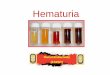 Hematuria - ipna-online.orgipna-online.org/Media/Hematuria_Ramzi El-Baroudy.pdf · Macroscopic (gross) Hematuria (visible red urine) Microscopic Hematuria >3RBCs/HPF from 2 of 3 urinary