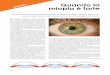 OCULISTA Quando la miopia è forte - VITA in COPPIA 2018 · Una persona affetta da miopia, astigma-tismo o ipermetropia che non tollera o non vuol portare l’occhiale o la lente