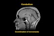 Cerebellum - is.muni.cz · Developmental anatomy Afferents from vestib. labyrinth fish, amphibians Archi- cerebellum VESTIBULO - CEREBELLUM Afferents from spinal cord and
