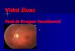 Vidni živac - en.zonavidaveselinovic.comen.zonavidaveselinovic.com/wp-content/uploads/2014/02/Vidni_Zivac-N.pdfNeuritis optohiasmatica. Papillitis Zapaljenje prednjeg dela vidnog