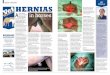 t HERNIAS - rossdales.com · Umbilical hernia before treatment Umbilical hernias are most commonly treated by the placement of a tight rubber ring around the excess skin of the hernia