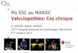 My ESC au MAROC Valvulopathies: Cas clinique ESC... · Observation clinique • Mr A. Abd, 62 ans, onsulte dans le adre d’un ilan pré opératoire d’une hirurgie ORL • Très