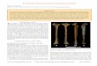 The Human Tibia from Broken Hill, Kabwe, Zambia · dle Stone Age artifacts in the main cave lithic assemblages, as well as Acheulian bifaces in adjacent deposits (cf. Clark 1950,