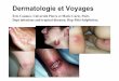 Dermatologie et Voyages - Infectiologie...Dermatologie et Voyages Eric Caumes. UniversitéPierre et Marie Curie, Paris Dept infectious and tropical diseases; Hop Pitié-Salpêtrière