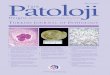 ISSN 1018-5615 Türk Dergisi - Turkish J Pathologyturkjpath.org/cover/cover_TPD_65.pdfISSN 1018-5615 Immunohistochemical Expression of p16 in Pleomorphic Salivary Adenoma Tükürük