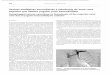 Varices esofágicas secundarias a trombosis de …scielo.isciii.es/pdf/nefrologia/v36n4/0211-6995-nefro...458 nefrologia 2016;36(4):444–463 Varices esofágicas secundarias a trombosis