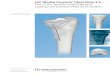 LCP Medial Proximal Tibial Plate 3.5. Part of the Synthes ... Mobile/Synthes International/Product Support