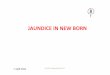 JAUNDICE IN NEW BORN7 April 2016* IAP UG Teaching slides 2015‐16 INCIDENCE Chemical hyperbilirubinemia • (> 2mg/dl) universal in newborns during 1st week Some degree of Jaundice