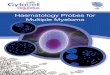 Haematology Probes for Multiple Myeloma · Cat. No. LPH 017-S (5 tests) Cat. No. LPH 017 (10 tests) P53 (TP53) Deletion The TP53 (tumour protein p53) gene at 17p13.1 is a tumour suppressor