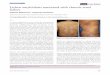 Letter to the Editor Lichen amyloidosis associated with ... · However, lichen amyloidosis associated with chronic renal failure has not been reported, and to our knowledge, this