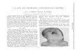 A CASE OF SPORADIC CONGENITAL GOITRE · A CASE OF SPORADIC CONGENITAL GOITRE BY A. L. D'ABREU and B. S. B. WOOD From the Children's Hospital, Birmingham (RECEIVED FOR PUBLICATION