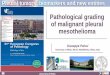 Pathological grading of malignant pleural …cpo-media.net/ECP/2019/Congress-Presentations/1163...L1, PD-L2, galectin-9) was downregulated or unaltered by CT agents (cisplatin) or