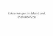 Erkrankungen im Mesopharynx - semmelweis.husemmelweis.hu/fulorrgegeszet/files/2019/09/07.-Erkrankungen-im-Mund-und-Mesopharynx.pdfKrankheit (Mediastinitis, Sepsis), sofortige Behandlung: