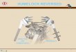 HUMELOCK REVERSED · 2018-01-14 · NO TRIALS ! Solid stem implanted after metaphyseal and epiphyseal rasping to compact cancellous bone and not using a reamer to remove it. ! The