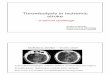 Thrombolysis in ischemic stroke · 2012-11-20 · 1 Thrombolysis in ischemic stroke - a clinical challenge Grethe Andersen Department of Neurology Århus University Hospital Ischemic