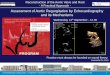 Assessment of Aortic Regurgitation by Echocardiography and ......Assessment of Aortic Regurgitation by Echocardiography and its Mechanisms Reconstruction of the Aortic Valve and Root