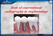 Role of conventional radiography in implantology · Discuss the importance of conventional tomography in localization of vital structures (Maxillary sinus & Inferior dental ... and