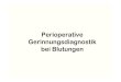 Perioperative Gerinnungsdiagnostik bei Blutungen DGTI-Koscielny (3).pdf · Perioperative Koagulopathien • Hypothermie • Azidose • Verdünnung • Volumengabe • Massivtransfusion