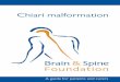 Chiari malformation - Brain & Spine Foundation · on Chiari malformations in adults, describing what a Chiari malformation is, associated conditions, possible treatments including