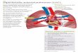 Hipertensão arterial pulmonar (HAP)cdn.cmjornal.pt/.../26-04-2015_00_36_09...Pulmonar.pdf · Hipertensão arterial pulmonar (HAP) Provocada pelo estreitamento dos vasos sanguíneos
