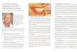 The Kind of Smile The Stages of a Smile Makeover ... · dentistry that is as healthy and functionaL aspossible. If you have-t/eeth that are worn, discolored, misshapen, mis-aligned