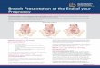 Breech Presentation at the End of your Pregnancy · Breech Presentation at the End of your Pregnancy Breech presentation occurs when your baby is lying bottom first or feet first