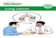 easy read Lung cancer - Macmillan Cancer Support · There are other treatments for lung cancer but the treatments that most people have are surgery, chemotherapy and radiotherapy