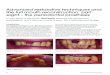 Advanced restorative techniques and the full mouth … · Advanced restorative techniques and the full mouth reconstruction: part eight – the periodontal prosthesis In part eight