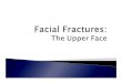 Facial Fracture Basics - West Virginia UniversityFacial Nerve Trigeminal Nerve ... `Early Versus Delayed Treatment `Closed Reduction (Local vs. General) `Drainage of Septal Hematoma