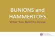BUNIONS and HAMMERTOES · Get progressively worse if untreated Can rub against your shoe and cause problems Never get better without some type of treatment IMPORTANT—Seek early