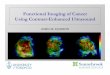 Functional Imaging of Cancer Using Contrast-Enhanced ... · PDF file – Introduce ultrasound contrast agents and highlight their unique properties – Describe how microbubble dynamics