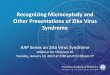 Recognizing Microcephaly and Other Presentations of Zika Virus … · 2017-01-12 · Webinar for Clinicians #1 Tuesday, January 10, 2017 at 2:00 pm ET/1:00 pm CT Recognizing Microcephaly