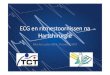 ECG en ritmestoornissen na Hartchirurgie - NVHVV M_ Lunter - ECG en ritmestoornissen post... · ECG • Elektrocardiografie = bestuderen van elektrische activiteit van het hart •
