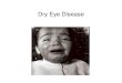 Dry Eye Disease - Sjogrens Society of Canadasjogrenscanada.org/wp-content/uploads/2013/01/... · What is dry eye? DEWS definition: 2007 • Dry eye is a multifactorial disease of