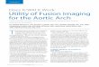 Does It/Will It Work: Utility of Fusion Imaging for the Aortic Archv2.evtoday.com/pdfs/et1116_F5_Haulon.pdf · Utility of Fusion Imaging for the Aortic Arch T he latest generation