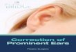 Correction of Prominent Ears - Marc Pacifico · Surgery to correct prominent ears reshapes the cartilage of the ear and sets the ear back closer to the scalp. You may also see it