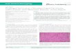 Prolonged Survival in a Nasopharyngeal Carcinoma (NPC ... · PDF file Prolonged Survival in a Nasopharyngeal Carcinoma (NPC) Patient with Metastatic Disease: A Case Report. De Meulenaere