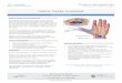 Hand Carpal Tunnel - Eastern Plastic Surgery€¦ · the hand. Carpal Tunnel Syndrome occurs when the median nerve is compressed by a strong ligament that covers the nerve and tendons
