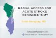 RADIAL ACCESS FOR ACUTE STROKE …...BACKGROUND Samir Sur et al. Transradial approach for mechanical thrombectomy in anterior circulation large-vessel occlusion. Journal of Neurosurgery,