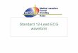 Standard 12-Lead ECG waveformStandard 12 lead ECG waveform Lead name: 69 V9R 68 V8R 67 V9 66 V8 65 -aVR 64 aVF 63 aVL Code Lead Standard 12 lead ECG waveform 1ch ECG 1ch ×12 recording