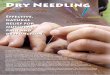 Dry Needling for Equinesfor Equines - Dr Victoria Hamilton ... › uploads › 4 › 3 › 0 › 6 › ... · Dry Needling has been used in humans since the 1940’s. Dr Janet Travell,