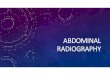 ABDOMINAL RADIOGRAPHY Abdomen.pdfPLAIN RADIOGRAPHY OF THE ABDOMEN •Plain abdominal radiography is traditionally the first radiological investigation in acute abdomen •Interpretation
