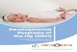 Developmental Dysplasia of the Hip (DDH) › static › uploads › files › ... · PDF file Developmental Dysplasia of the Hip (DDH) is a condition in which your baby’s hip joint