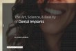 The Art, Science, & Beauty of Dental Implants...98 percent of dental implant cases are successful, allowing for amazing predictability of results. Up to 94% of cases remain successful