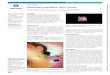 Penetrating paediatric neck trauma - BMJ Case …...Penetrating paediatric neck trauma Monica abdelmasih, 1 ahmed Kayssi, 2 Graham roche-Nagle 3 Reminder of important clinical lesson