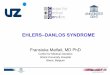 EHLERS–DANLOS SYNDROME - BSTH · PDF file 2016-04-01 · Classic Ehlers–Danlos syndrome • Major diagnostic criteria: ‣ Skin hyperextensibility ‣ Widened atrophic scars ‣