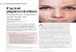 PEER REVIEWED FEATURE 2 CPD POINTS Facial pigmentation · systemic lupus erythematosus and naevus of Hori (also known as acquired bilateral naevus of Ota) similarly have broad spectrums