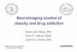 Neuroimaging studies of obesity and drug addiction · 2016-08-09 · obesity and drug addiction. Brookhaven Science Associates U.S. Department of Energy VTA/SN nucleus accumbens frontal