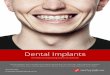Dental Implants...Dental Implants The stable and long lasting solution for tooth loss Dental implants are a durable and long lasting solution for tooth loss. With improved comfort,